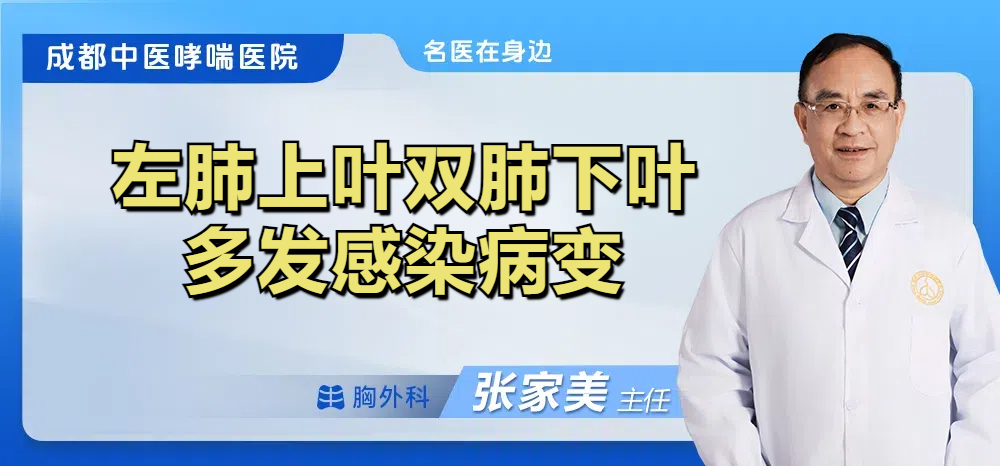 左肺上叶双肺下叶多发感染病变